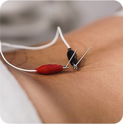 Neuromodulación