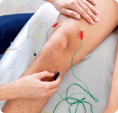 Neuromodulación
