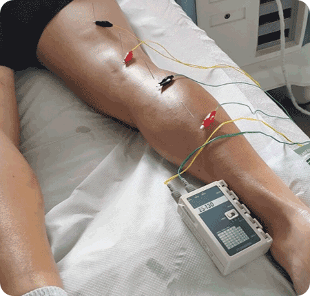 Neuromodulación