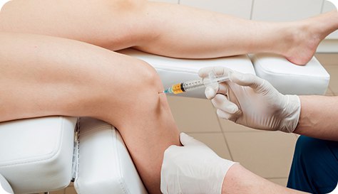 Infiltración en la artrosis de rodilla