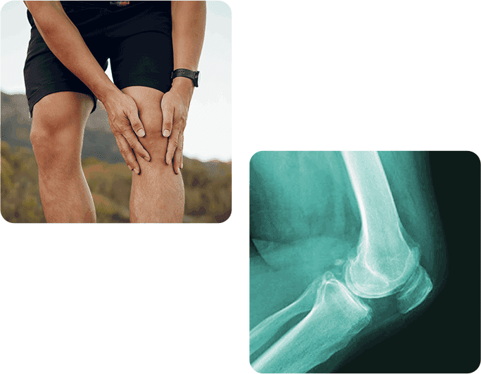 Rodilla